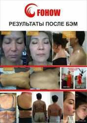 Біоенергетичний апаратний масаж «Fohow-2018» 2